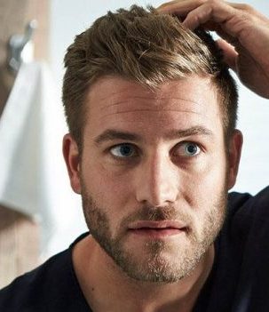 All About Male Dandruff How to Prevent, End and Myths