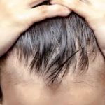 Complete Treatment for Baldness How to Make The Strands Grow Strong Again! No Myths or Miracles