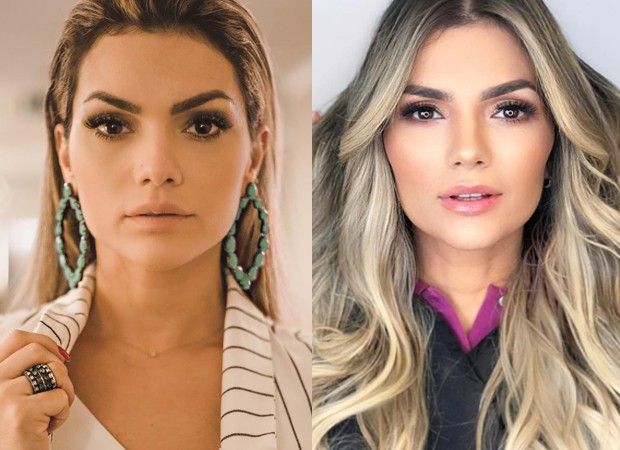 5 Antes e Depois de Harmonização Facial de Famosos